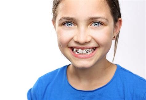 Smile Spell Denton TX FAQs: Everything You Need to Know